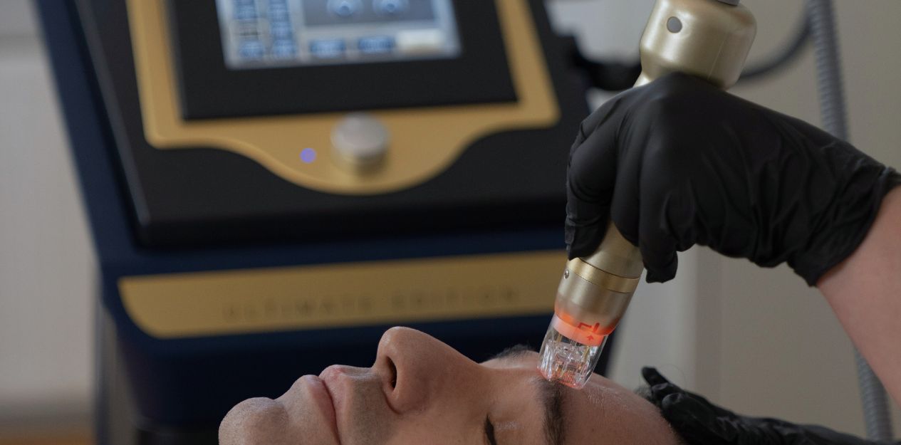 RF Sylfirm Behandlung RF Sylfirm Behandlung für Hautstraffung