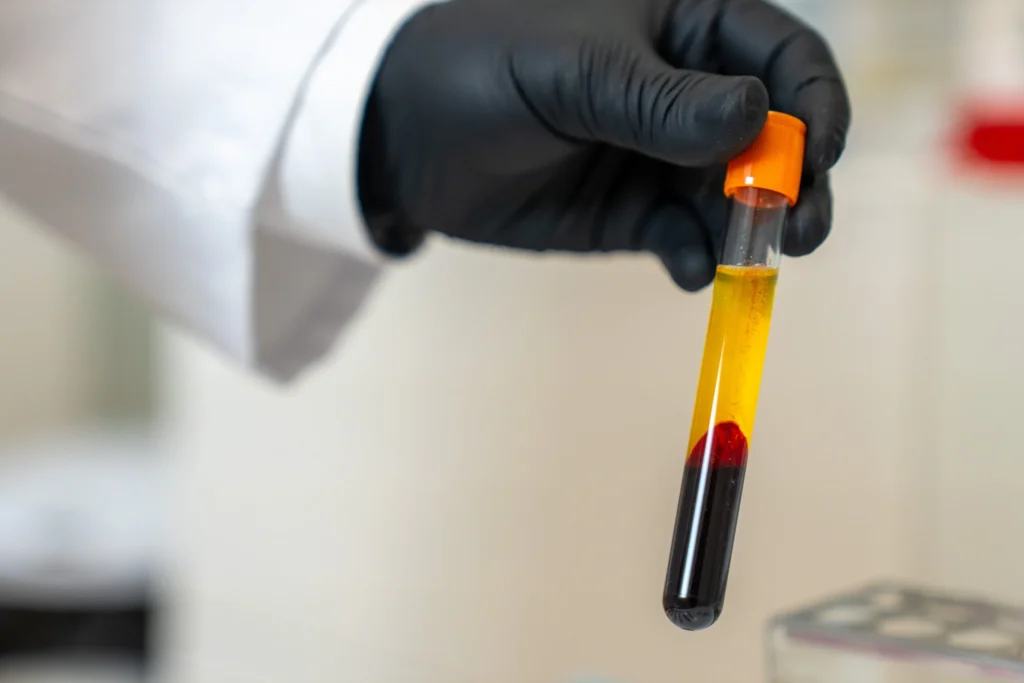 PRF Behandlung in Berlin