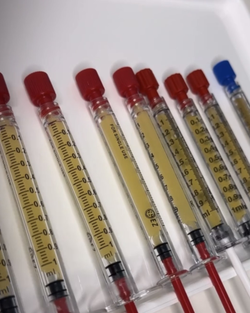 PRF-Röhrchen nach der Zentrifugation